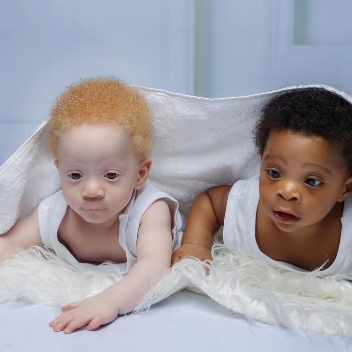 Фотография: В чем секрет близнецов с разным цветом кожи из Нигерии №5 - BigPicture.ru