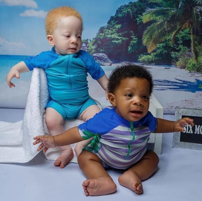Фотография: В чем секрет близнецов с разным цветом кожи из Нигерии №11 - BigPicture.ru