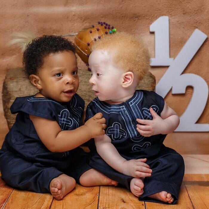 Фотография: В чем секрет близнецов с разным цветом кожи из Нигерии №10 - BigPicture.ru