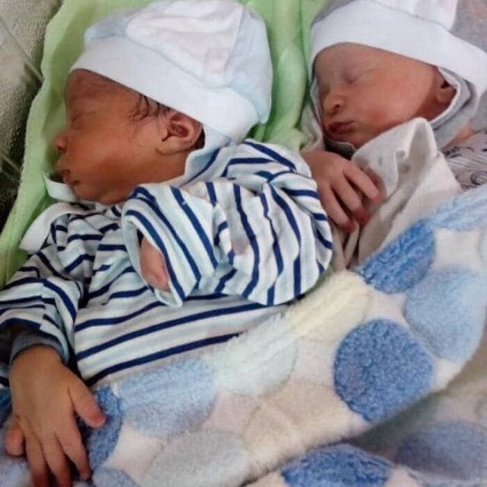 Фотография: В чем секрет близнецов с разным цветом кожи из Нигерии №2 - BigPicture.ru