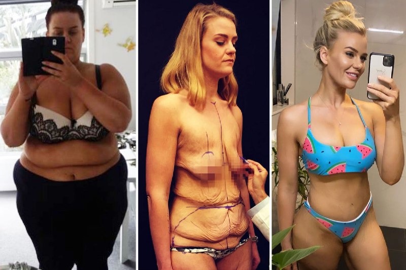 Фотография: Новое тело — новая жизнь: девушка изменилась до неузнаваемости, похудев на 90 кг №1 - BigPicture.ru