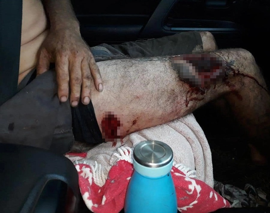 Фотография: Месть жертвы: огромный умирающий буйвол нанес последний удар охотнику, оставив страшные раны №4 - BigPicture.ru