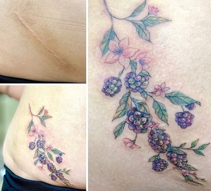 25 татуировок для перекрытия шрамов и других дефектов на теле