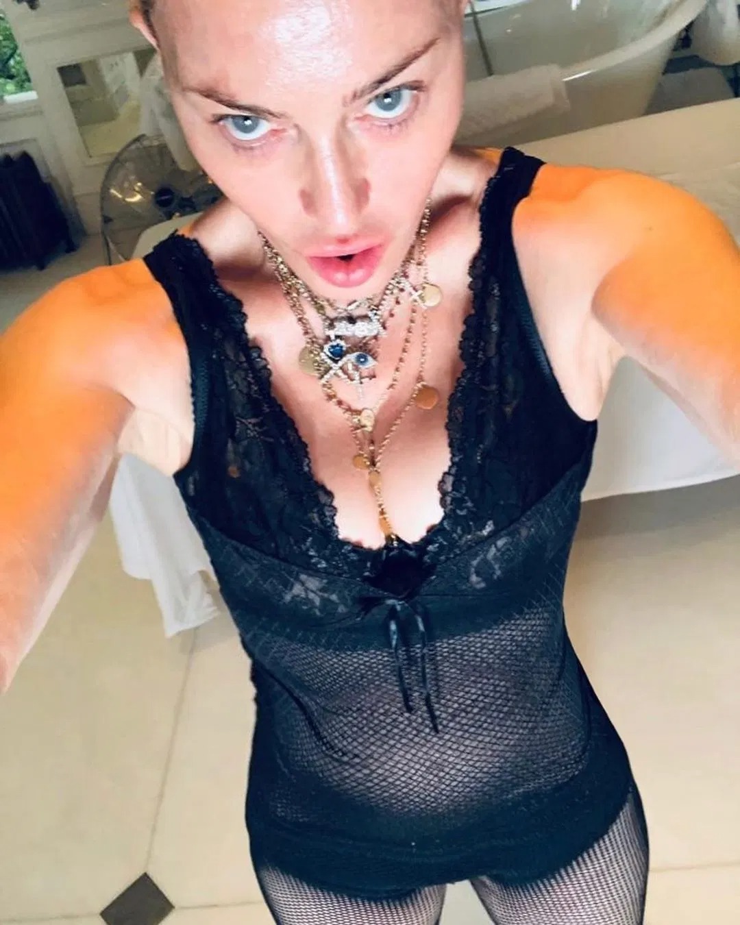 Фотография: Топлес и с костылем: 61-летняя Мадонна поразила подписчиков странным селфи №3 - BigPicture.ru