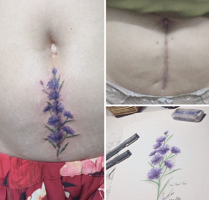 Фотография: 25 татуировок для перекрытия шрамов и других дефектов на теле №14 - BigPicture.ru