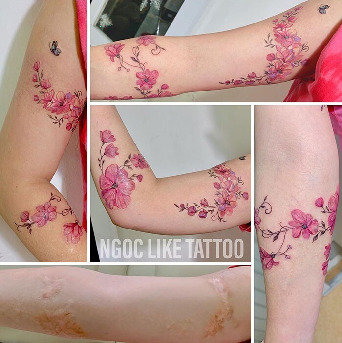 Фотография: 25 татуировок для перекрытия шрамов и других дефектов на теле №3 - BigPicture.ru