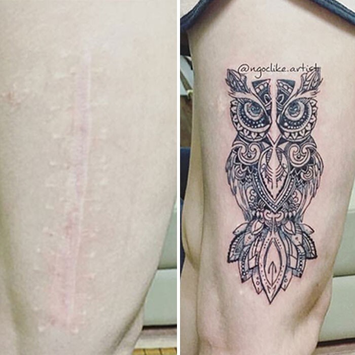 Фотография: 25 татуировок для перекрытия шрамов и других дефектов на теле №18 - BigPicture.ru