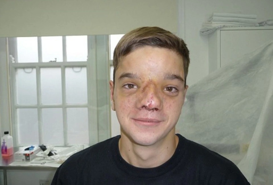 Фотография: Британский солдат собрал деньги на операцию для мальчика из Боснии, который родился с редким дефектом на лице №8 - BigPicture.ru