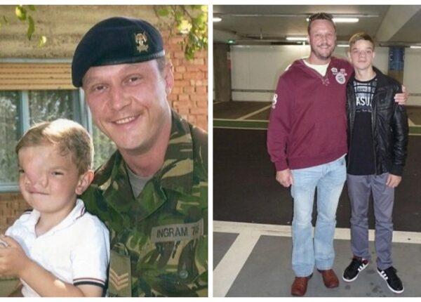 Британский солдат собрал деньги на операцию для мальчика из Боснии, который родился с редким дефектом на лице
