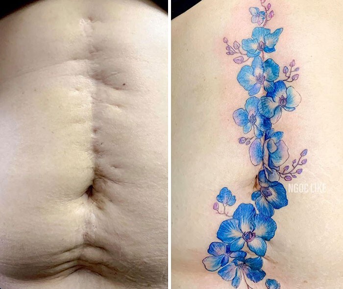 Фотография: 25 татуировок для перекрытия шрамов и других дефектов на теле №25 - BigPicture.ru