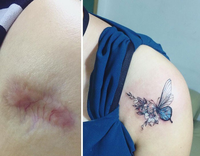 Фотография: 25 татуировок для перекрытия шрамов и других дефектов на теле №16 - BigPicture.ru
