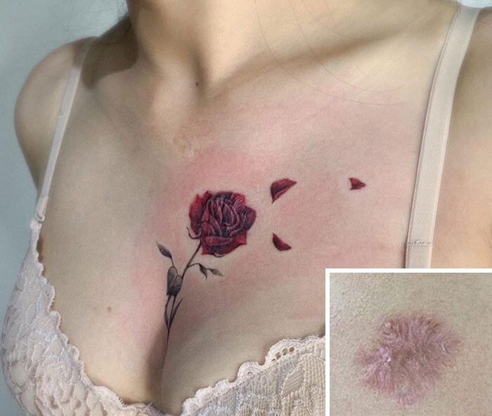 Фотография: 25 татуировок для перекрытия шрамов и других дефектов на теле №19 - BigPicture.ru