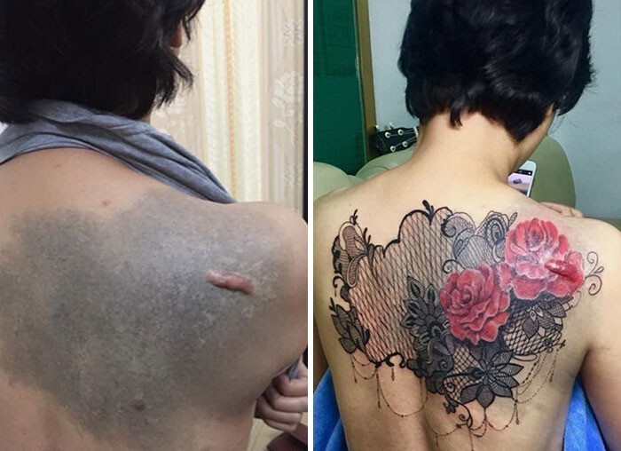 Фотография: 25 татуировок для перекрытия шрамов и других дефектов на теле №5 - BigPicture.ru
