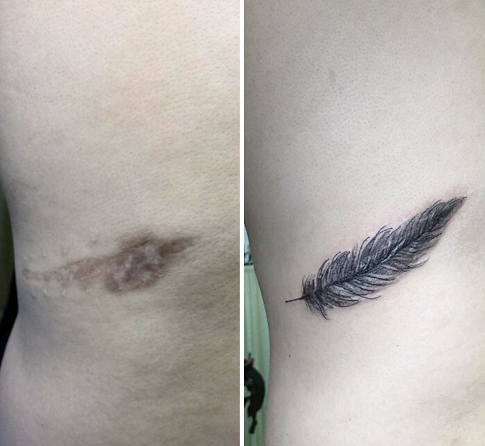 Фотография: 25 татуировок для перекрытия шрамов и других дефектов на теле №8 - BigPicture.ru