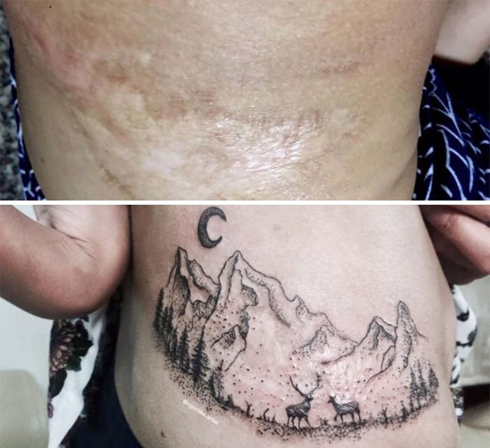 Фотография: 25 татуировок для перекрытия шрамов и других дефектов на теле №27 - BigPicture.ru