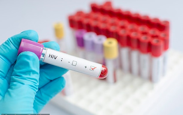 Фотография: В США зафиксирован случай излечения от ВИЧ без терапии №3 - BigPicture.ru