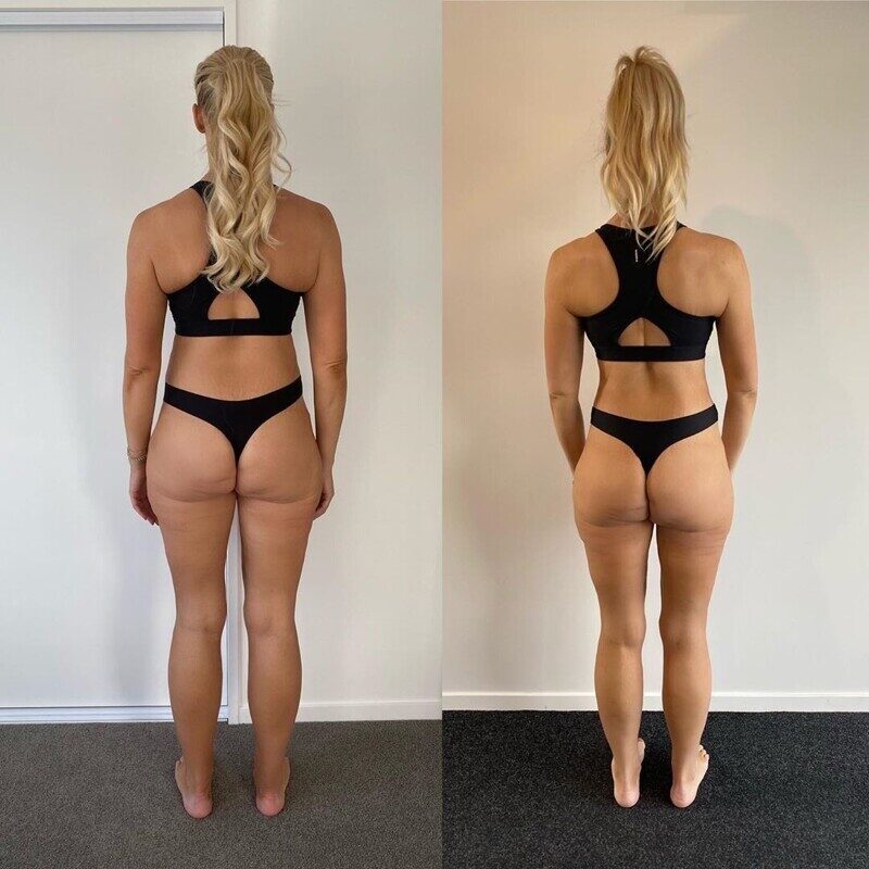 Фотография: 25-летняя новозеландка похудела на центнер и показала фото процесса преображения №5 - BigPicture.ru