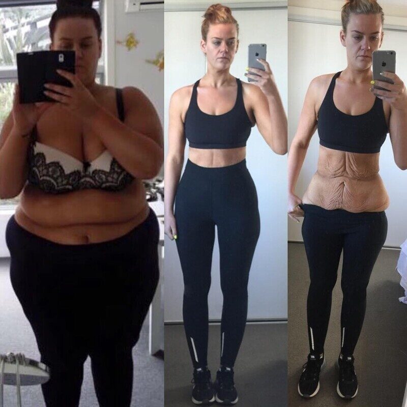 Фотография: 25-летняя новозеландка похудела на центнер и показала фото процесса преображения №3 - BigPicture.ru
