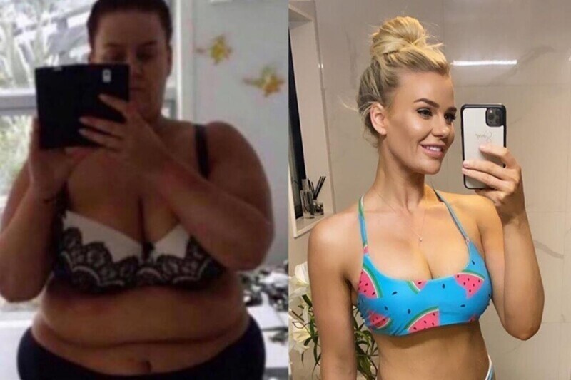 Фотография: 25-летняя новозеландка похудела на центнер и показала фото процесса преображения №1 - BigPicture.ru