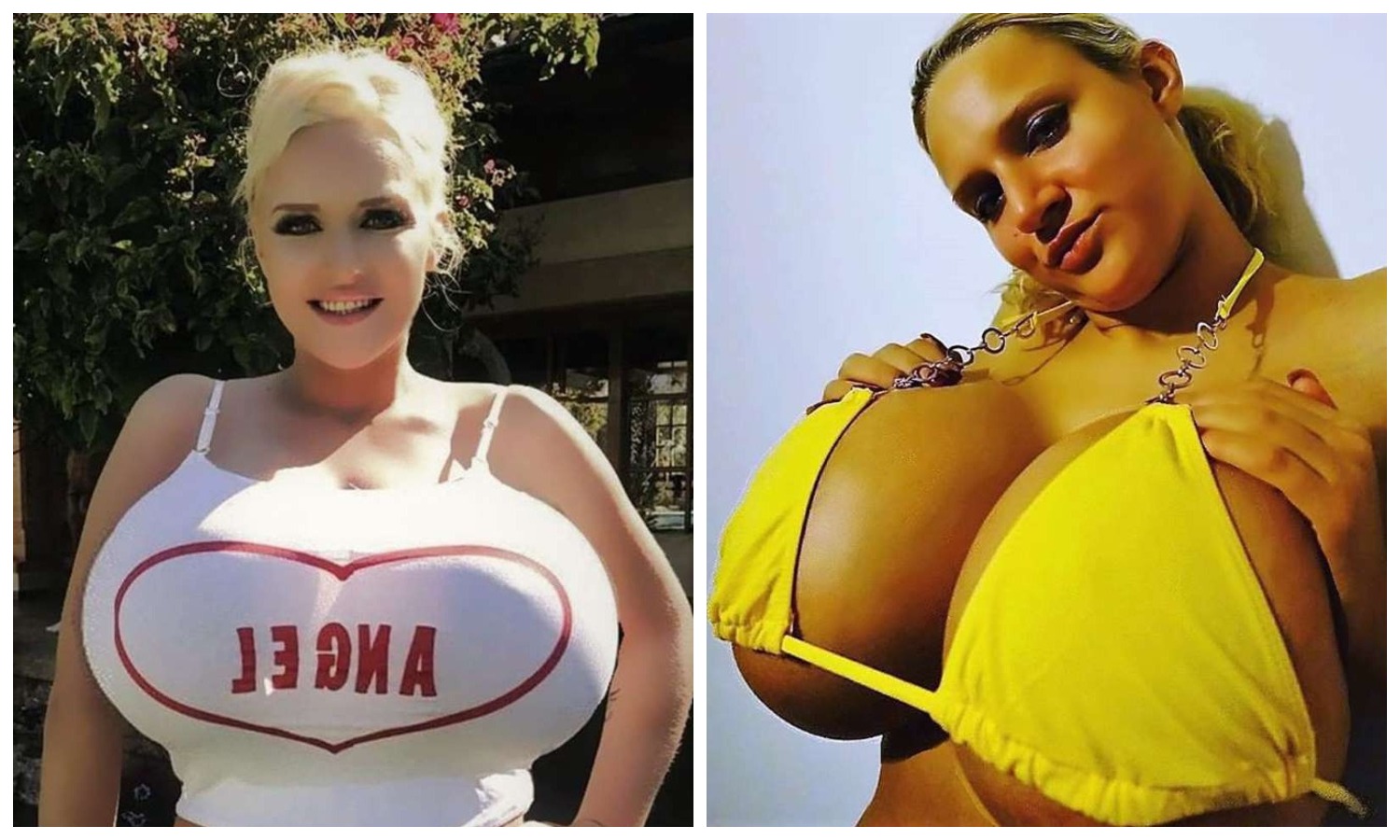 Фотография: Большая изюминка: У британки такая огромная грудь, что она не может водить машину №1 - BigPicture.ru