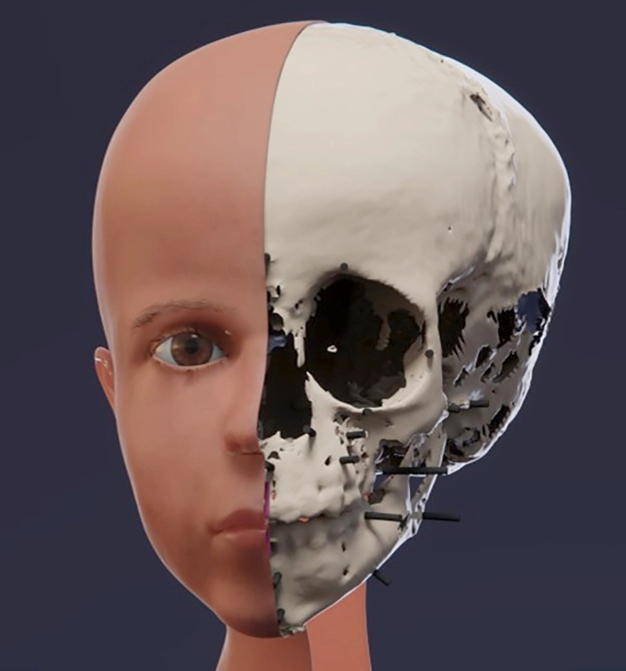 Фотография: Лицо из прошлого: Ученые воссоздали внешность 3-летнего мальчика из египетской мумии №4 - BigPicture.ru