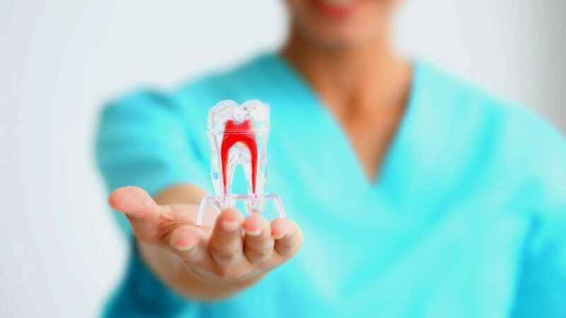 Фотография: Зубная киста и ее лечение: все, что надо знать о коварном заболевании №1 - BigPicture.ru