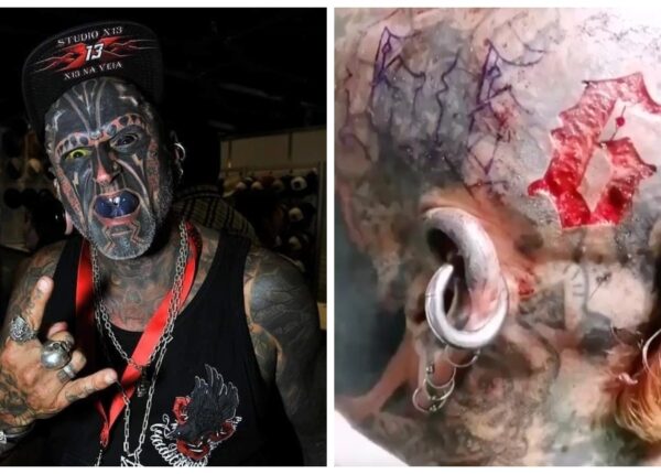 Число зверя: одержимый татуировками уругваец хочет вырезать на черепе «666»