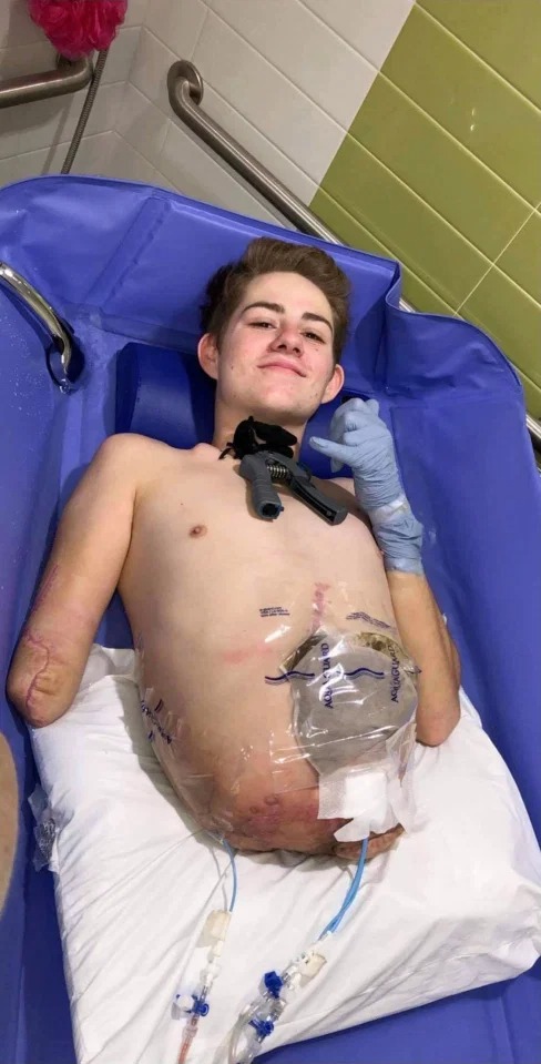 Фотография: Победитель смерти: как 19-летний американец живет после ампутации нижней части тела №2 - BigPicture.ru