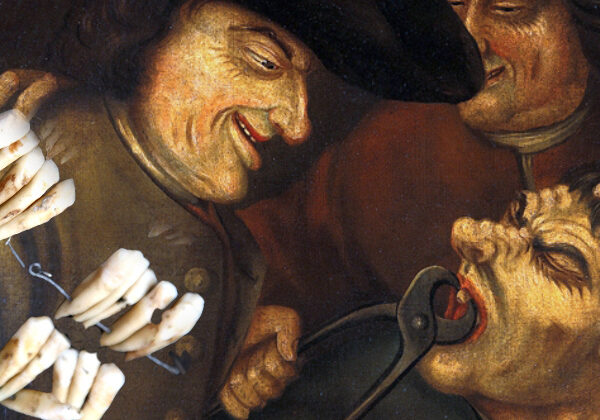 Что такое «зубы Ватерлоо», или Как битва 1815 года повлияла на развитие стоматологии