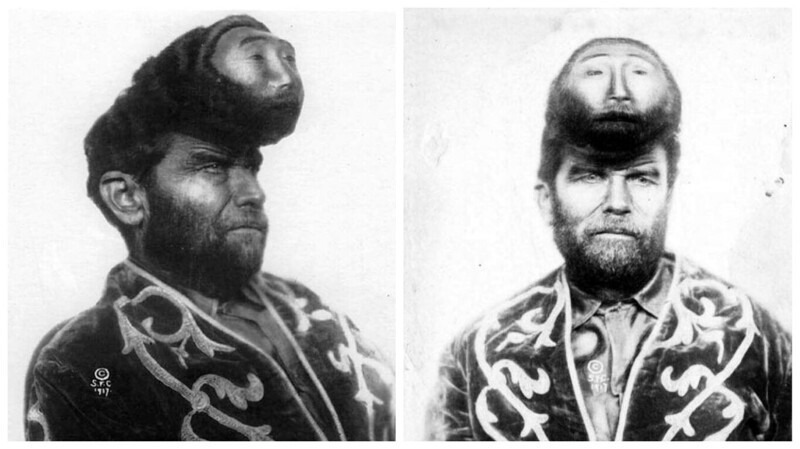 Фотография: Человек с двумя головами: портреты Паскуаля Пиньона, начало ХХ века №1 - BigPicture.ru