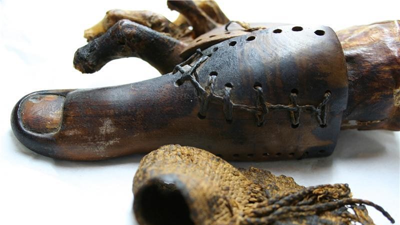 Фотография: 22 жутких предмета из прошлого, от которых мурашки идут по коже №11 - BigPicture.ru