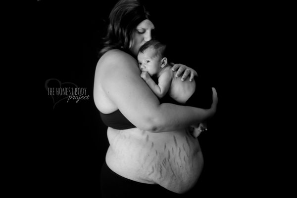 Фотография: Откровенный фотопроект: как на самом деле выглядят женщины после родов №12 - BigPicture.ru