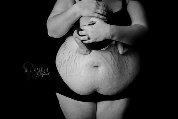 Фотография: Откровенный фотопроект: как на самом деле выглядят женщины после родов №9 - BigPicture.ru