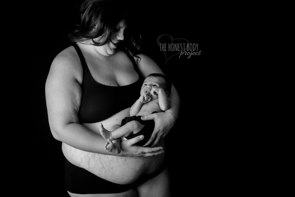 Фотография: Откровенный фотопроект: как на самом деле выглядят женщины после родов №19 - BigPicture.ru