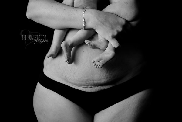 Фотография: Откровенный фотопроект: как на самом деле выглядят женщины после родов №29 - BigPicture.ru