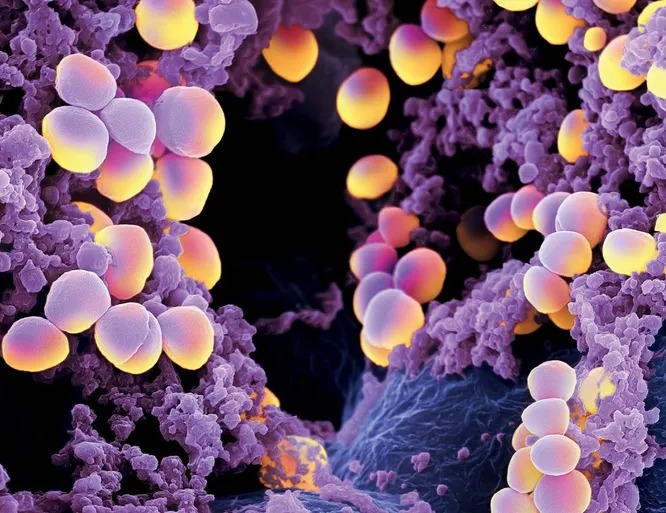 Фотография: 10 самых опасных бактерий №8 - BigPicture.ru