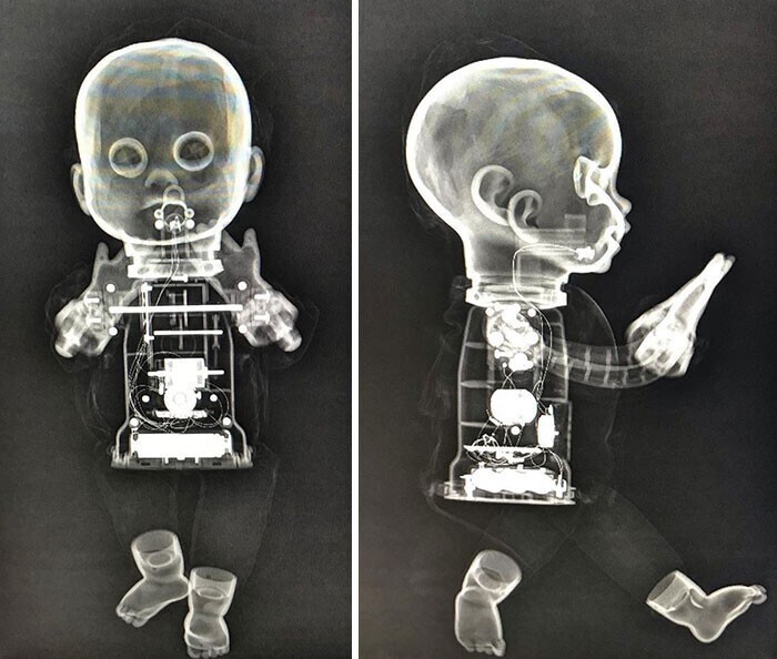 Рентгеновские снимки