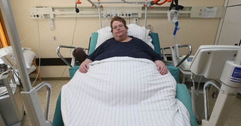 В США мужчине с ожирением случайно сделали кесарево сечение