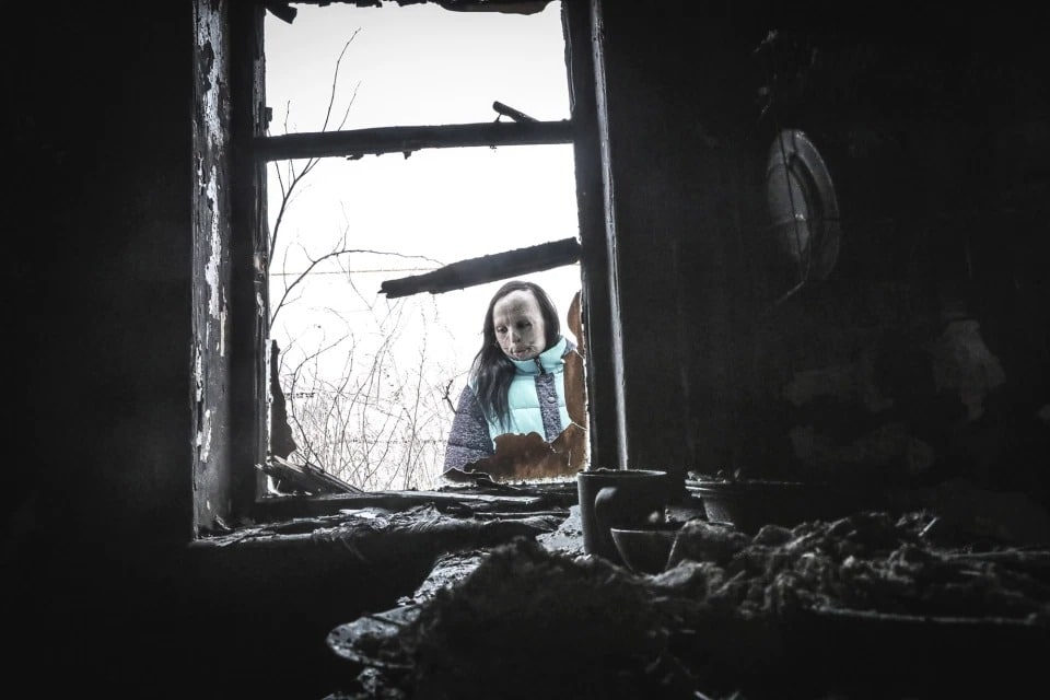 Фотография: История Ани Болдыревой, которая лишилась лица из-за пожара, но надеется на лучшую жизнь №2 - BigPicture.ru