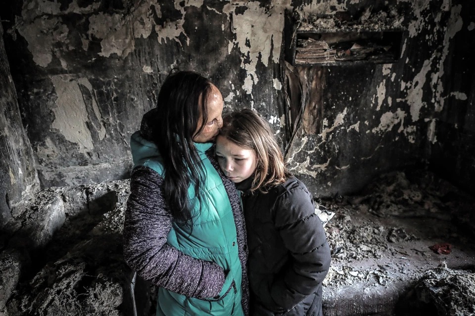 Фотография: История Ани Болдыревой, которая лишилась лица из-за пожара, но надеется на лучшую жизнь №9 - BigPicture.ru