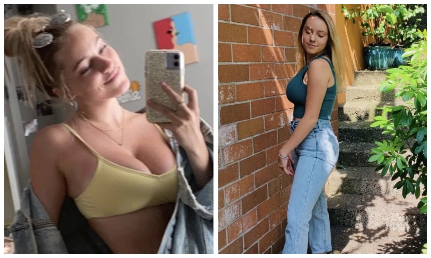 Гора с плеч: 18-летняя американка рассказала, как улучшилась ее жизнь после уменьшения груди