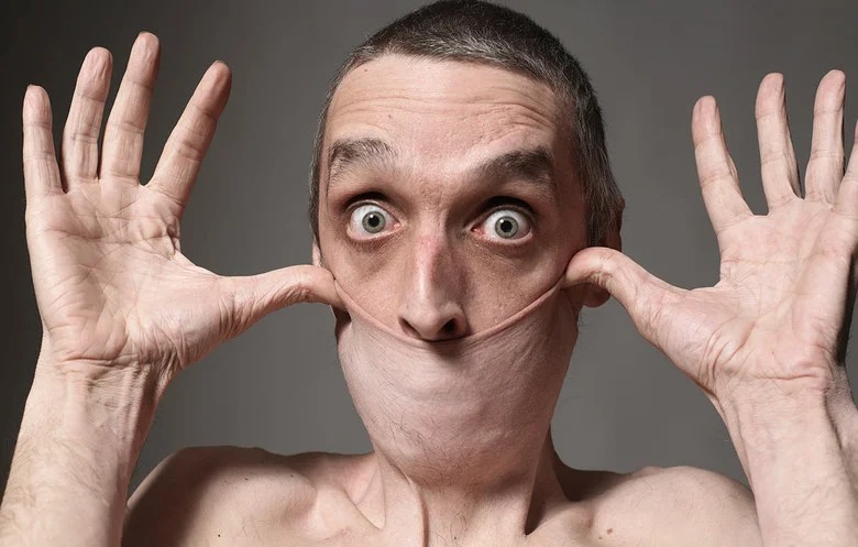 Фотография: Резиновое лицо: как живет Гарри Тёрнер, человек с самой эластичной кожей в мире №1 - BigPicture.ru
