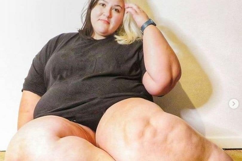 Фотография: Британка изнуряла себя диетами, чтобы ее ноги похудели, но это была болезнь №1 - BigPicture.ru
