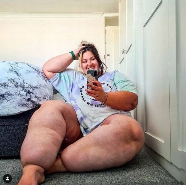 Фотография: Британка изнуряла себя диетами, чтобы ее ноги похудели, но это была болезнь №3 - BigPicture.ru