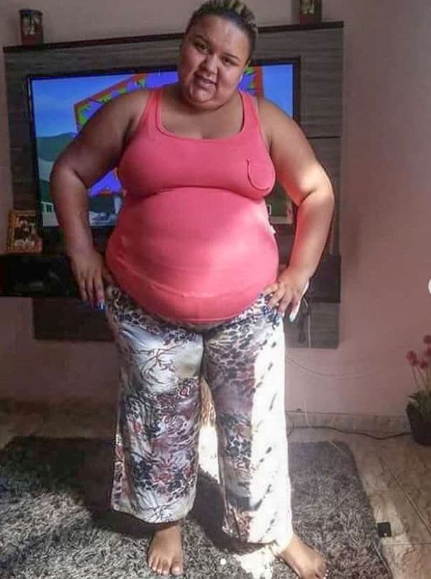 Фотография: Молодая мать из Бразилии за два года похудела на 70 кг и стала успешной моделью №2 - BigPicture.ru