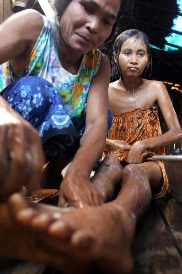 Фотография: Найденная в джунглях: печальная история камбоджийской женщины-Маугли №2 - BigPicture.ru