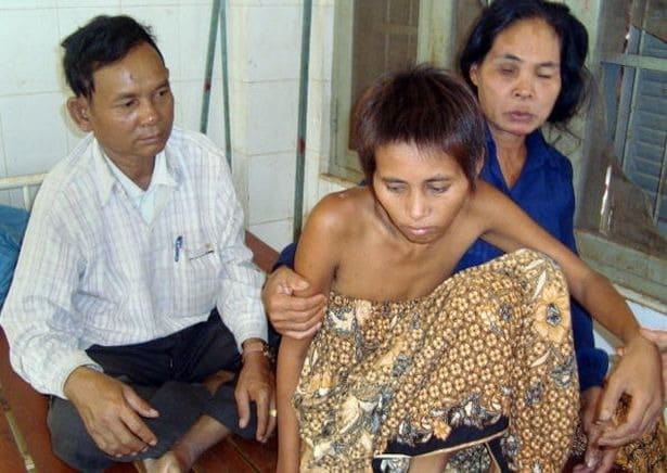 Фотография: Найденная в джунглях: печальная история камбоджийской женщины-Маугли №3 - BigPicture.ru