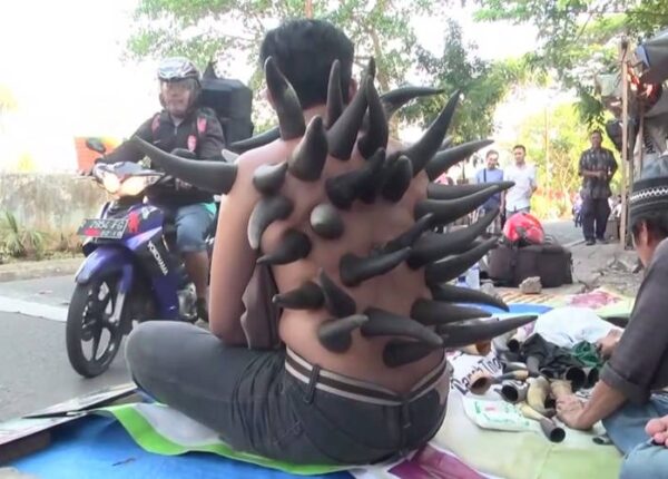 Зачем в Индонезии уличные целители ставят рога на спину пациентам