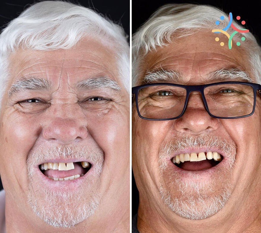 Фотография: 30 фото до и после того, как людям вернули улыбку №11 - BigPicture.ru