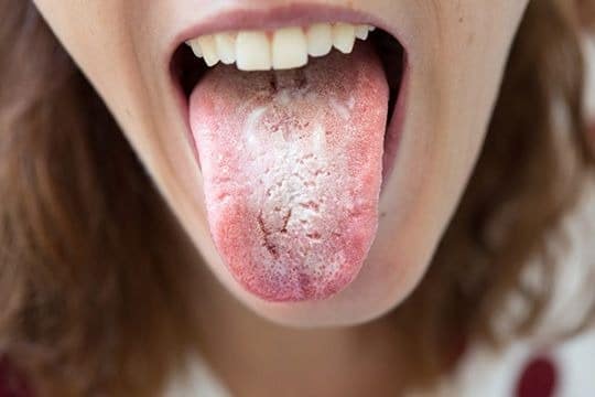Фотография: Читай по зубам! 5 признаков болезней, которые можно обнаружить во рту №5 - BigPicture.ru